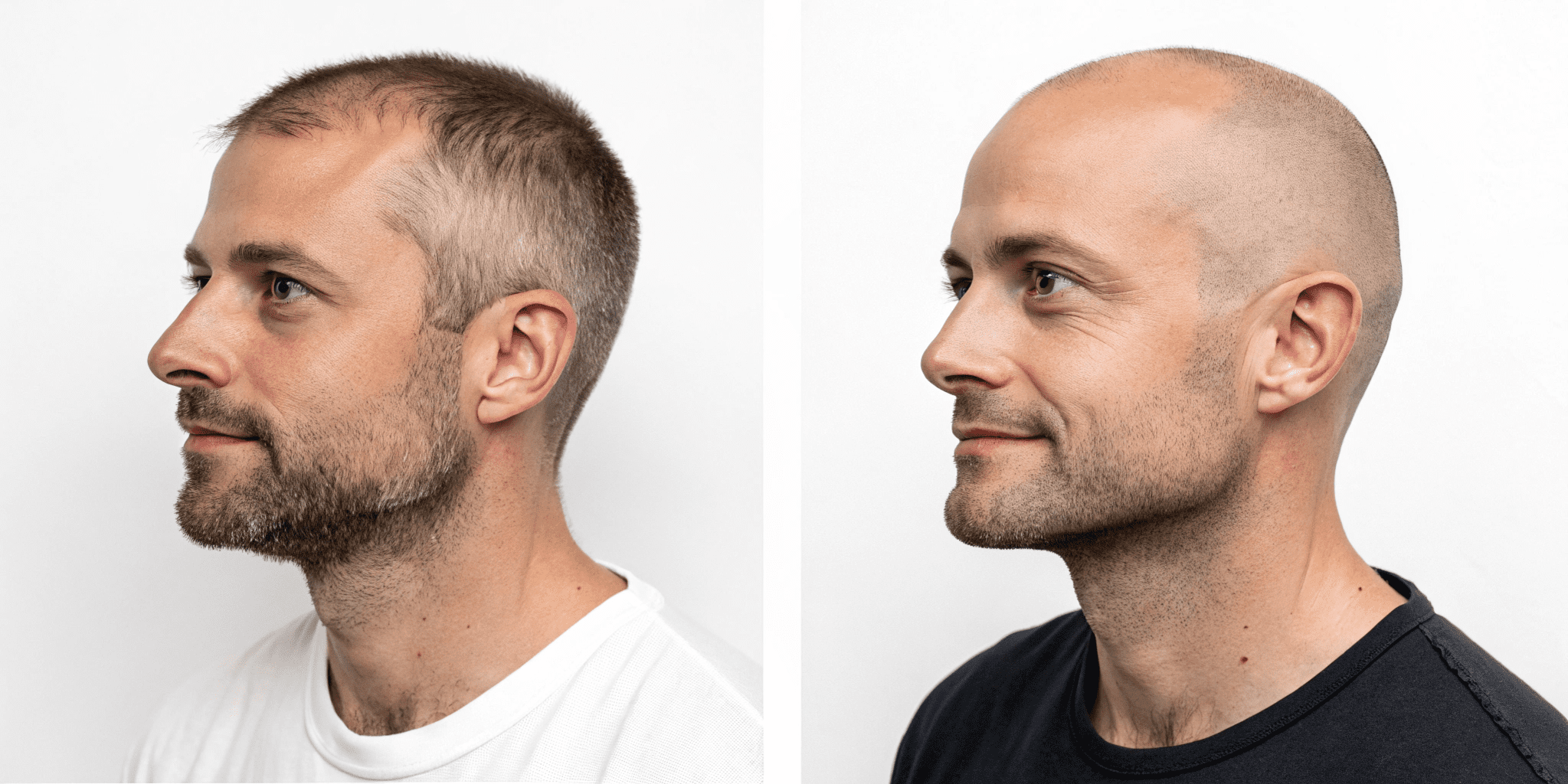 شیور مردانه